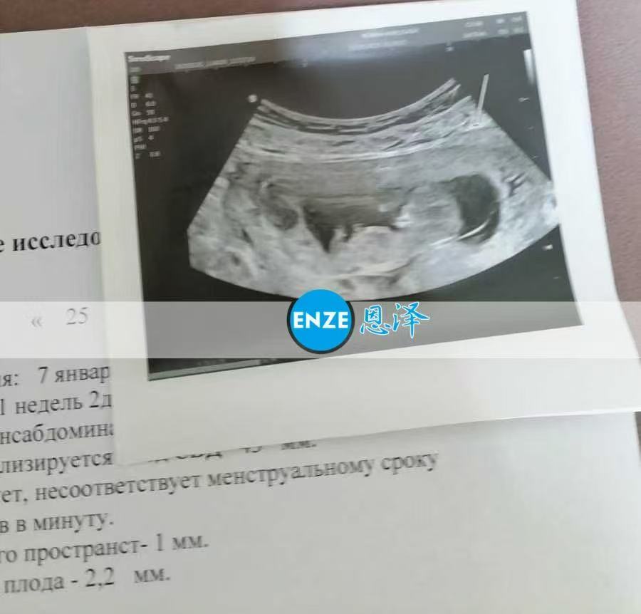 格鲁吉亚代孕代孕代母11周产检顺利通过