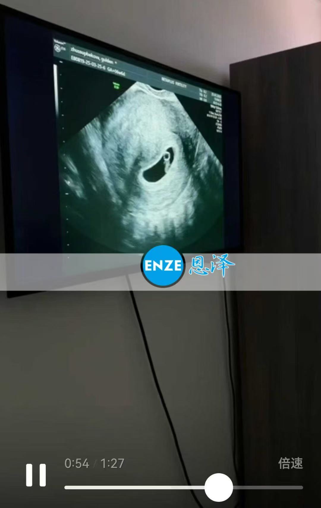 格鲁吉亚代孕代孕代母成功通过6周产检