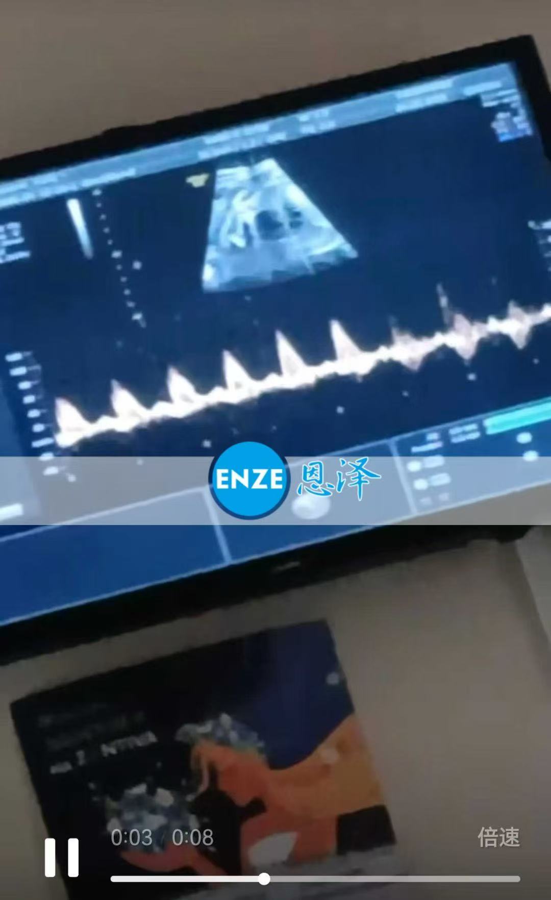 乌克兰代孕代孕代母26周产检顺利过关