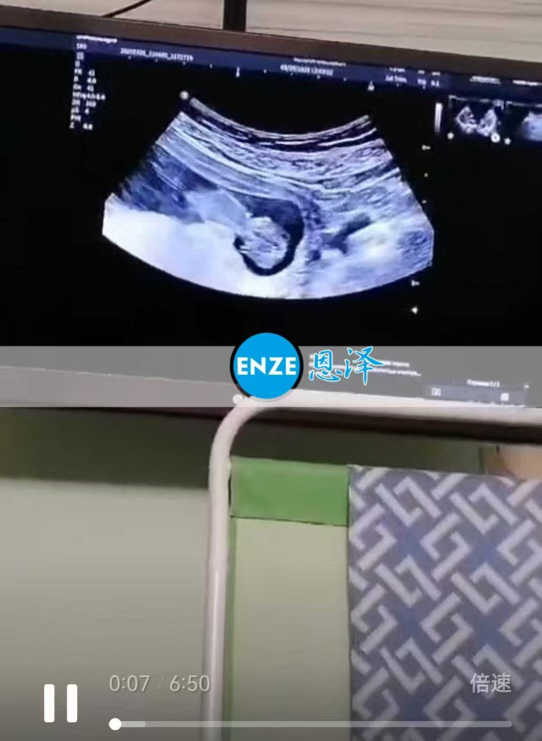 格鲁吉亚代孕代孕代母11周产检顺利通过