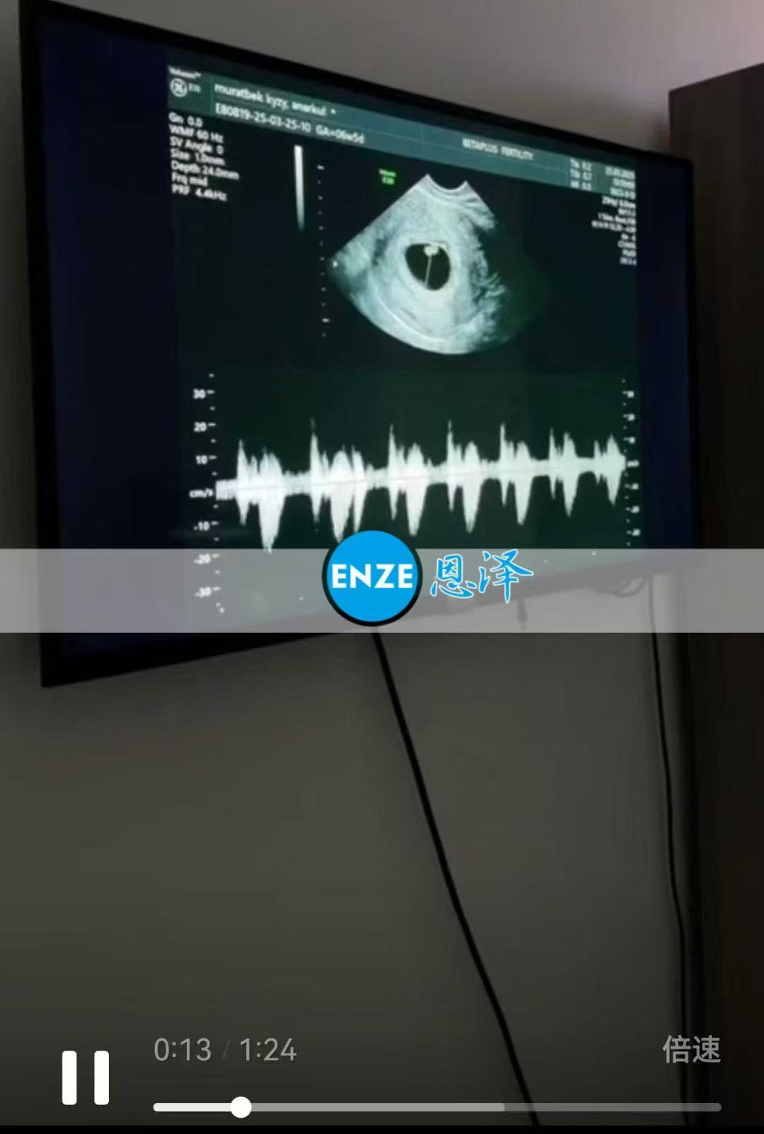格鲁吉亚代孕代孕代母6周产检顺利通过