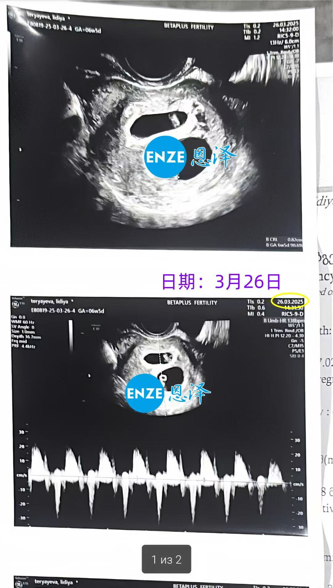 格鲁吉亚代孕代孕代母喜获双胎