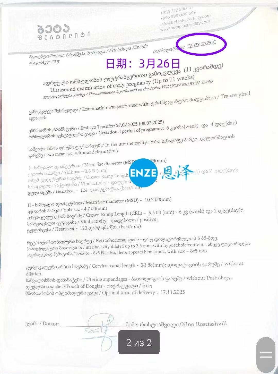 格鲁吉亚代孕代孕代母成功怀上双胎