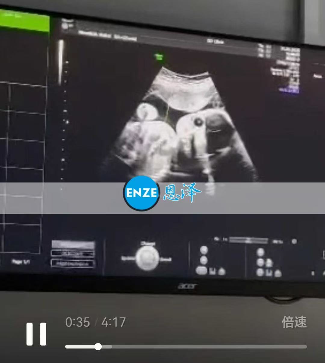 格鲁吉亚代孕代孕代母26周产检顺利通过
