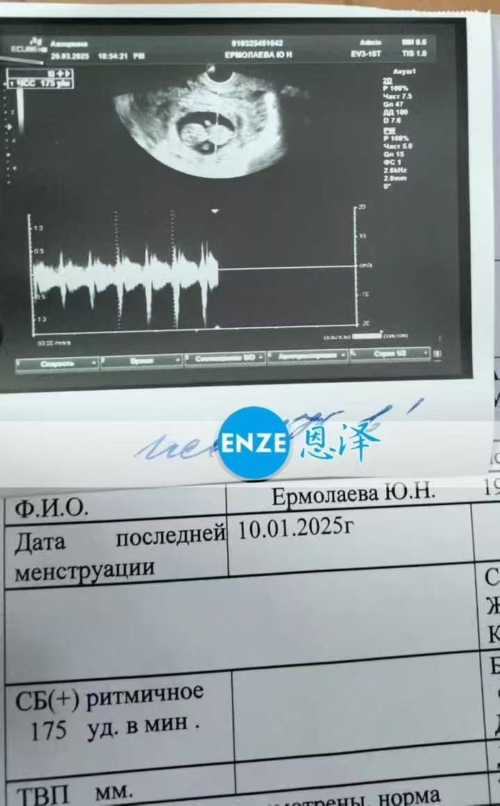 格鲁吉亚代孕代孕代母顺利通过11周产检