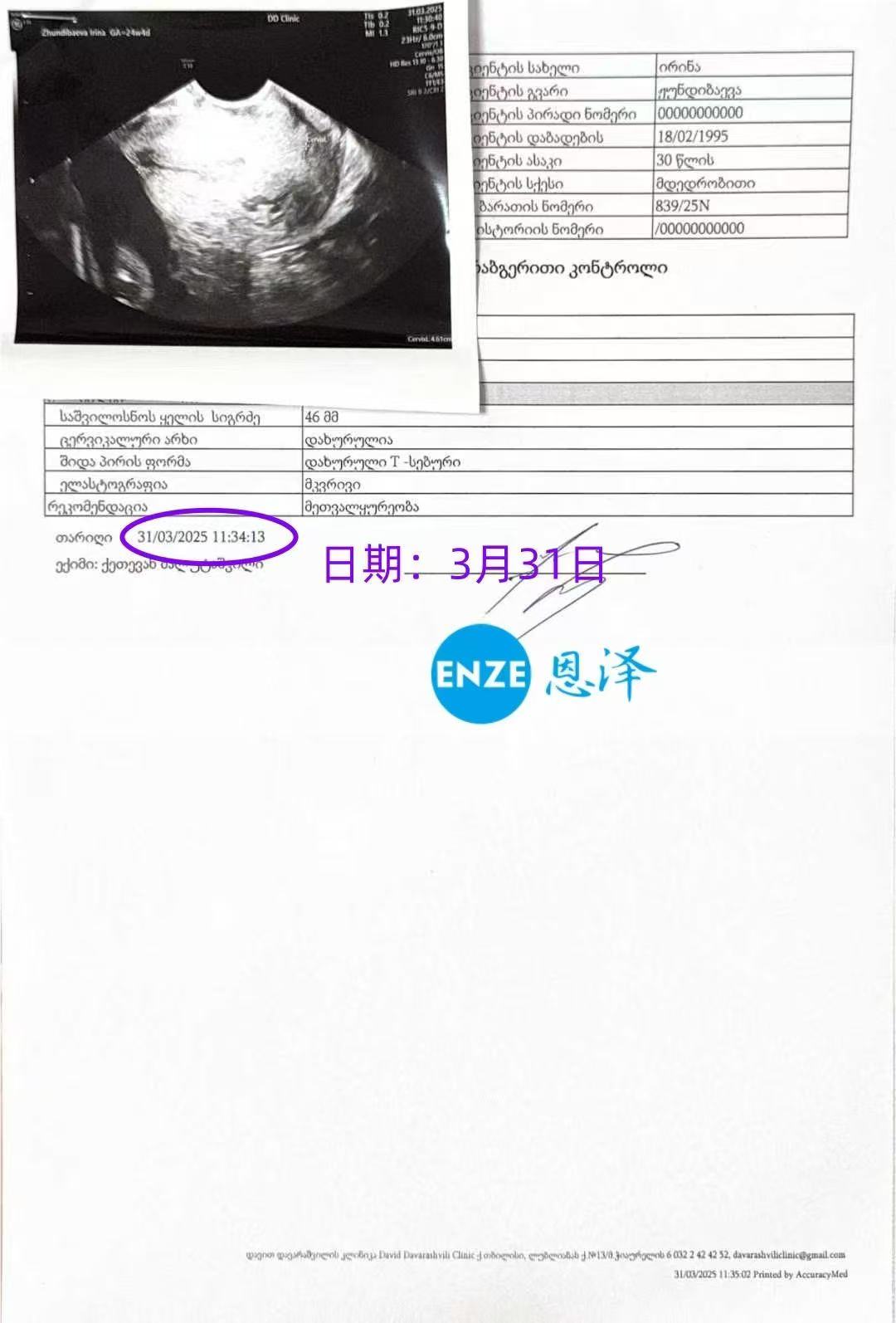 格鲁吉亚代孕代孕代母24周产检顺利通过