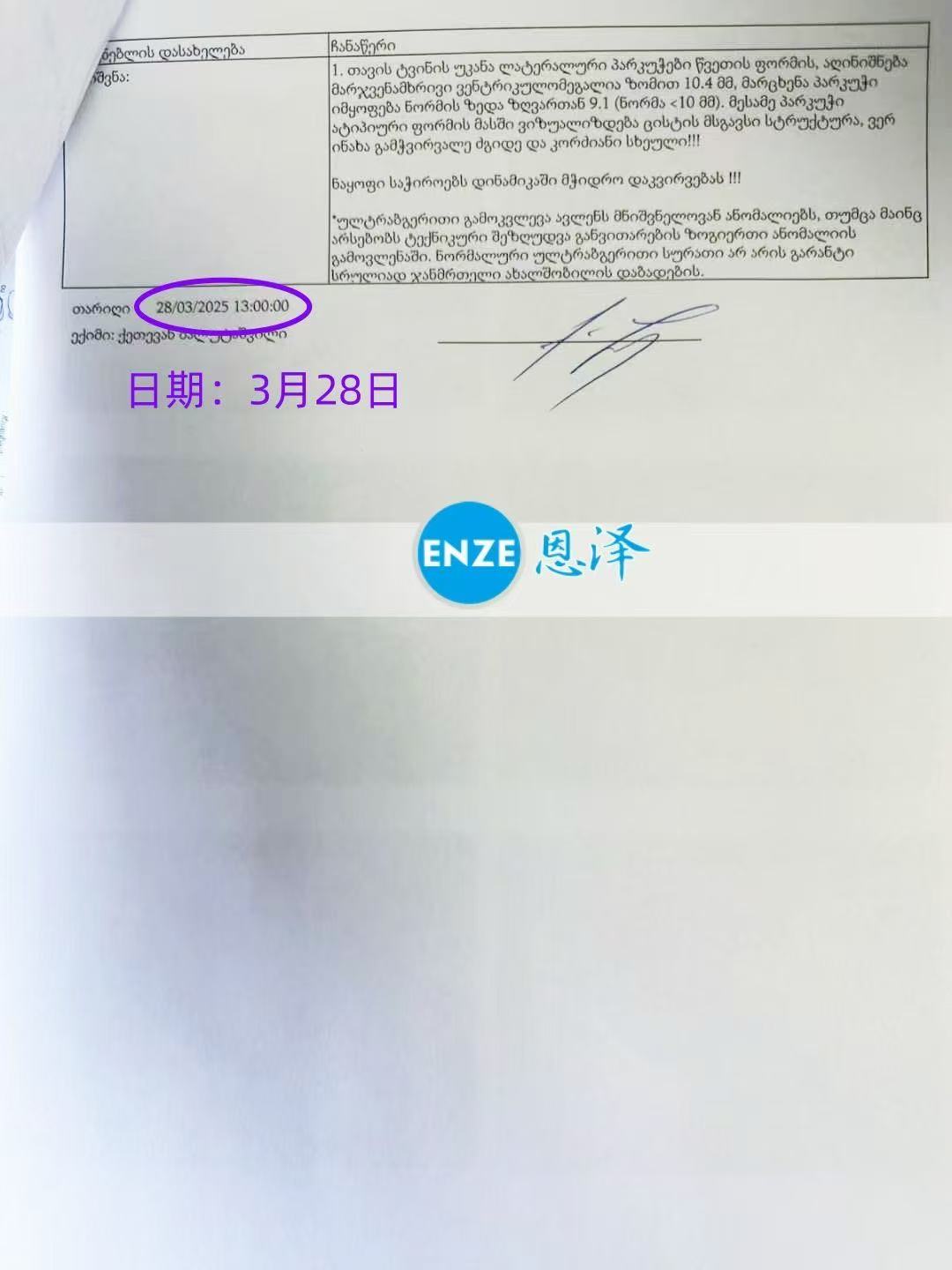 格鲁吉亚代孕代孕代母成功通过25周产检