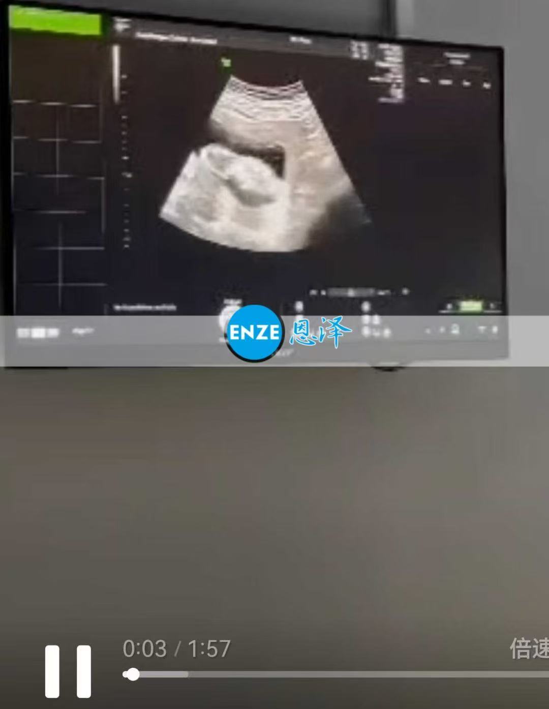 格鲁吉亚代孕代孕代母13周产检成功利通过