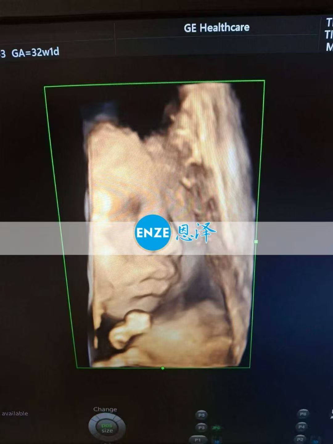 乌克兰代孕代孕代母32周产检顺利通过