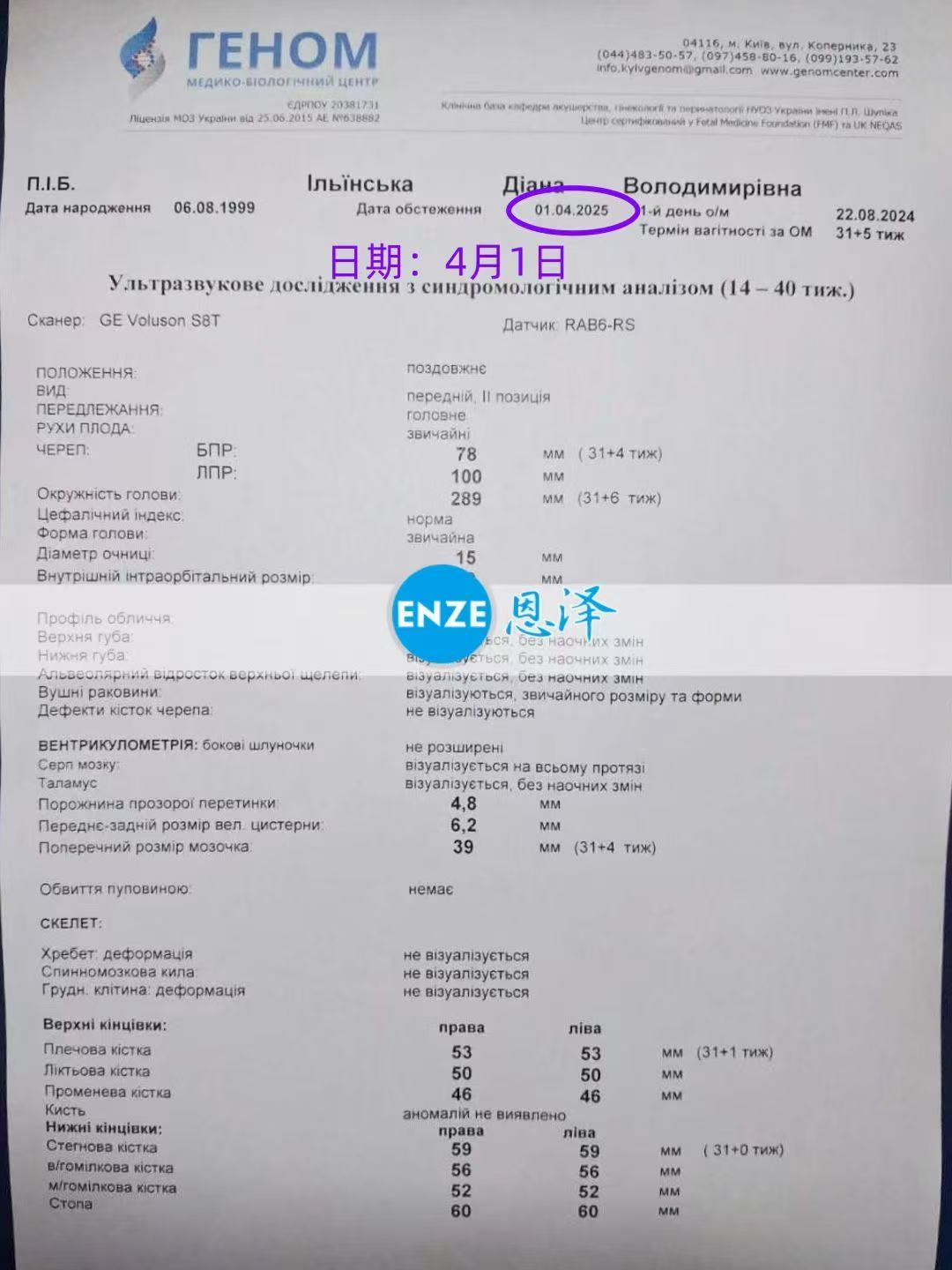 格鲁吉亚代孕代孕代母31周产检顺利通过
