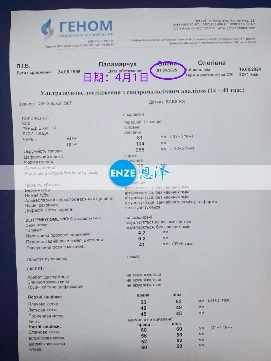 乌克兰代孕代孕代母32周产检顺利通过
