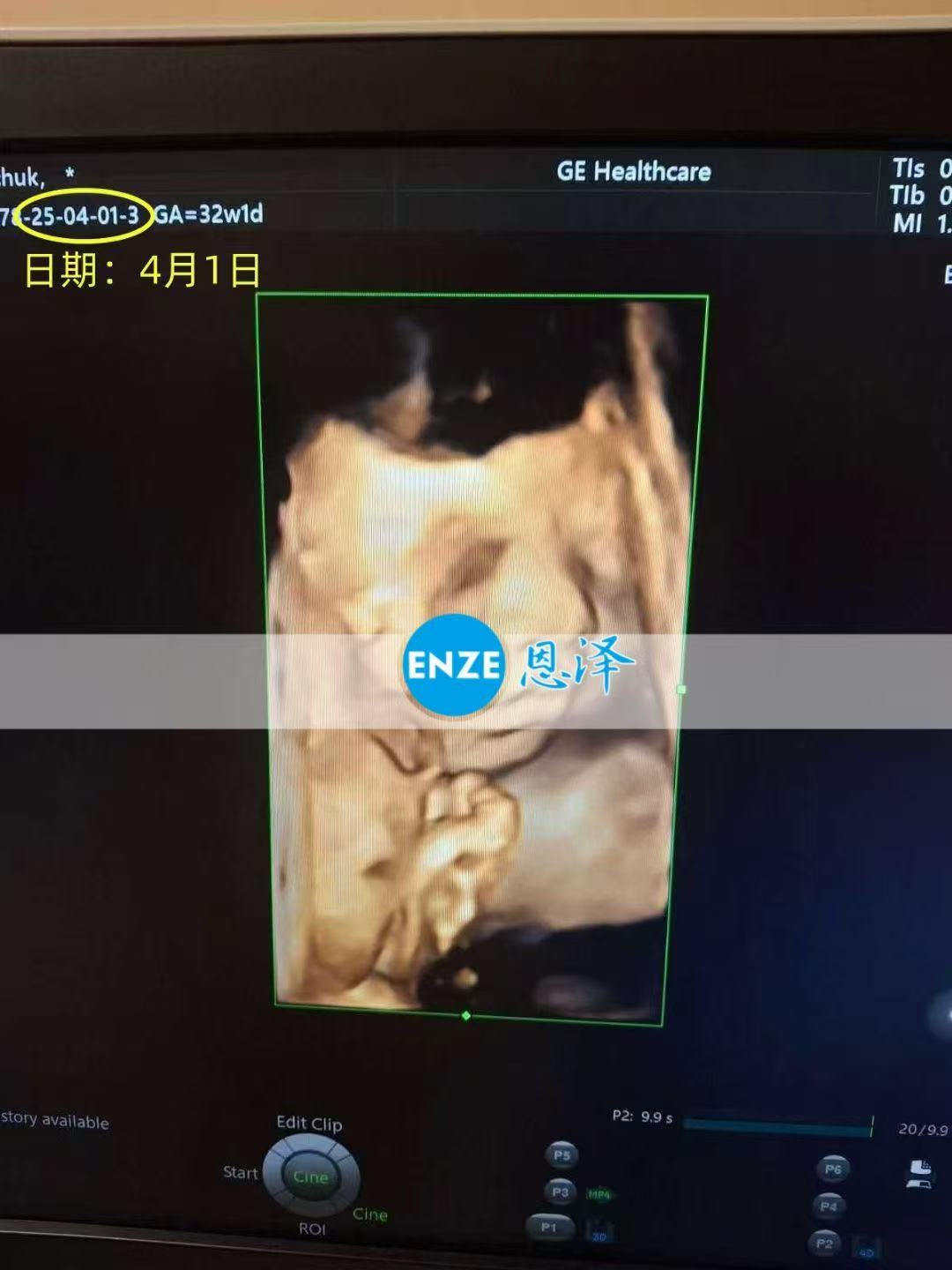乌克兰代孕代孕代母32周产检顺利通过