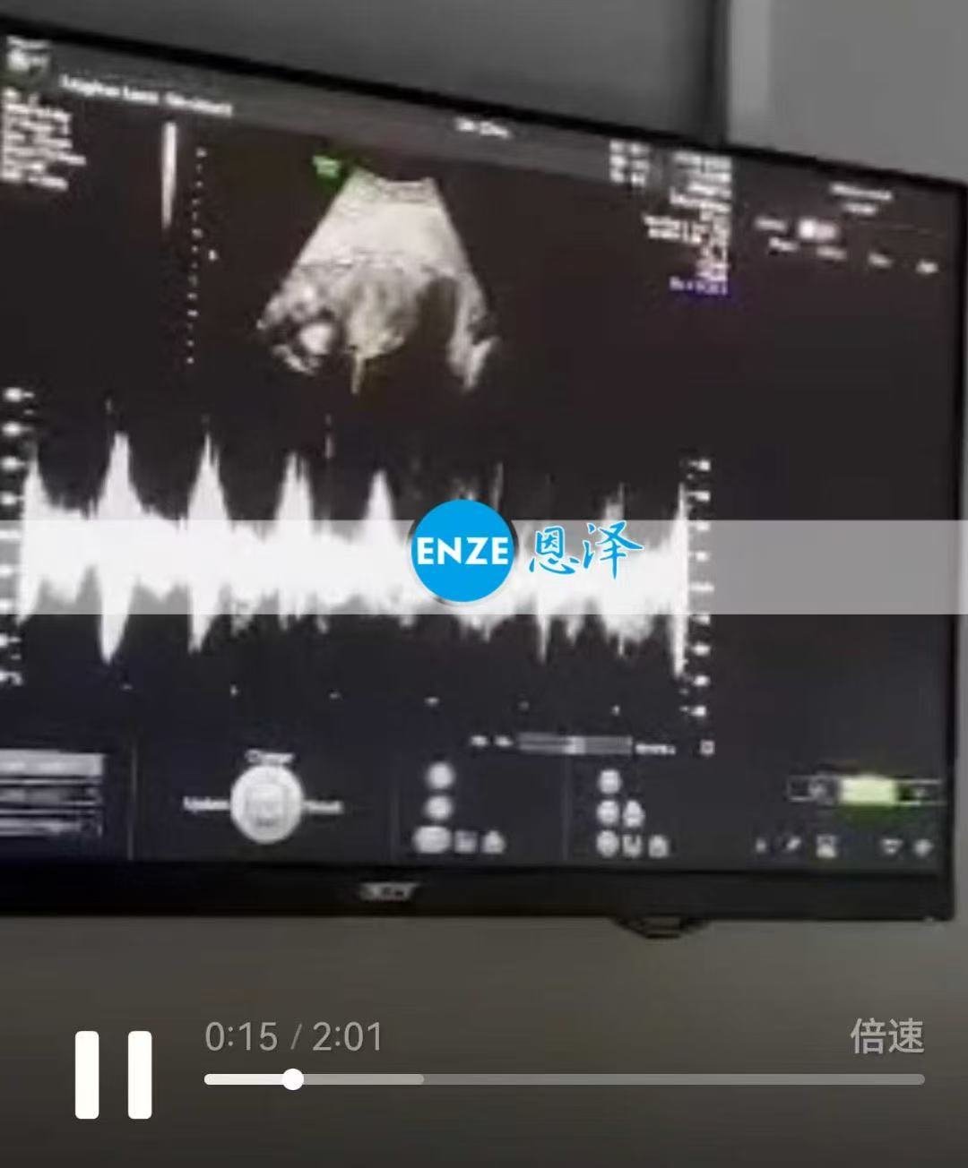 格鲁吉亚代孕代孕代母26周产检顺利通过