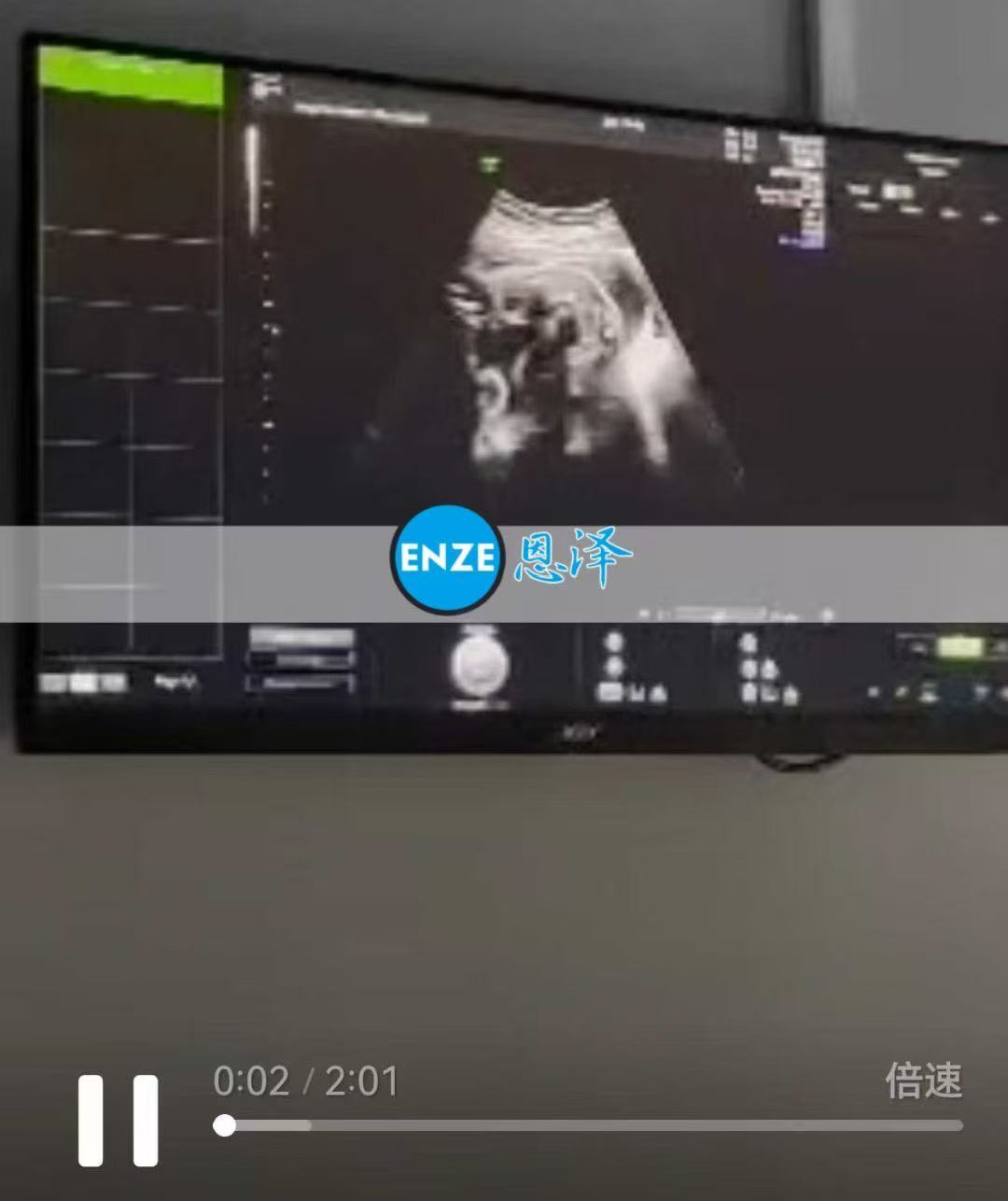 格鲁吉亚代孕代孕代母26周产检顺利通过