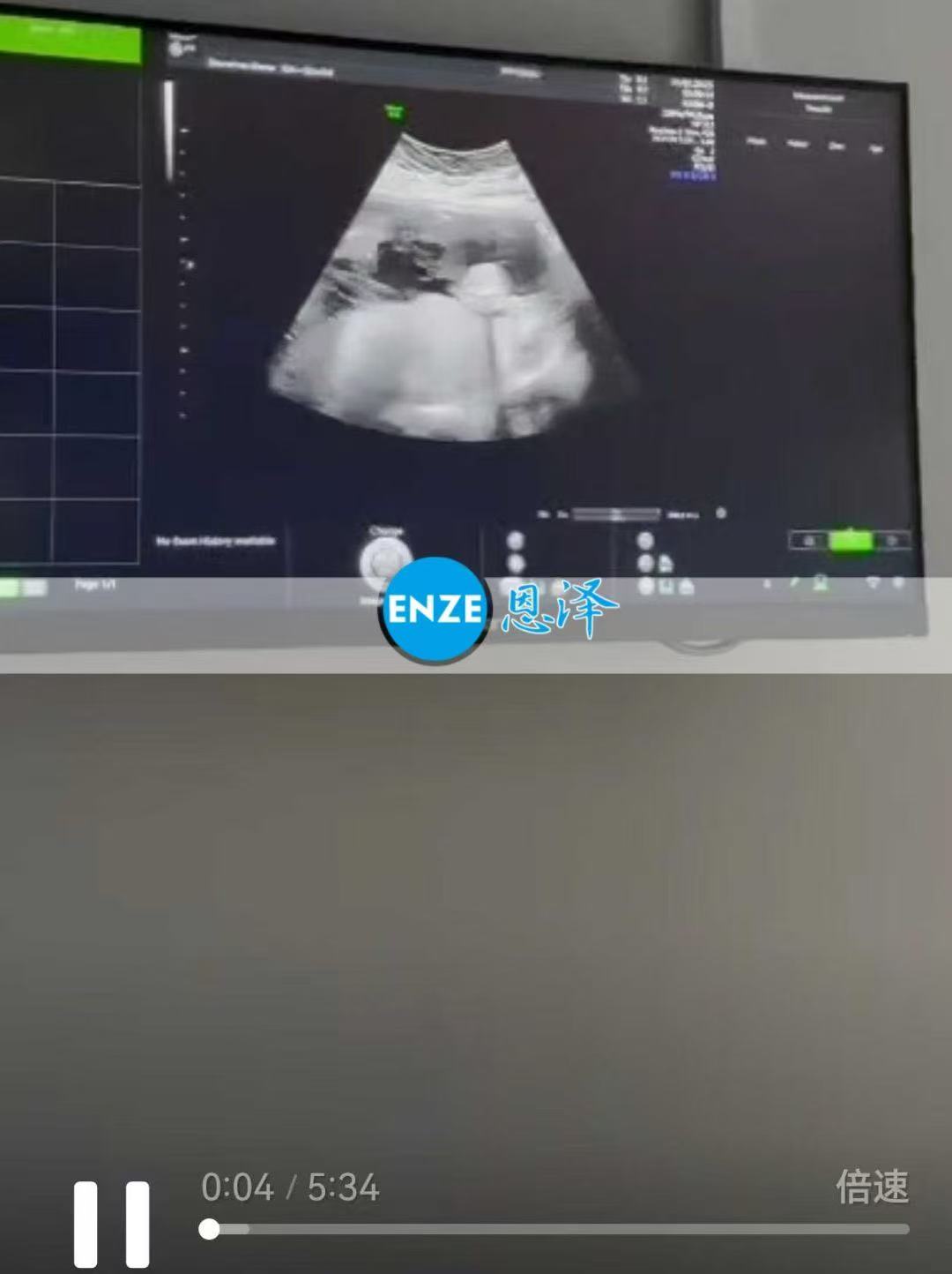 格鲁吉亚代孕代孕代母22周产检顺利通过