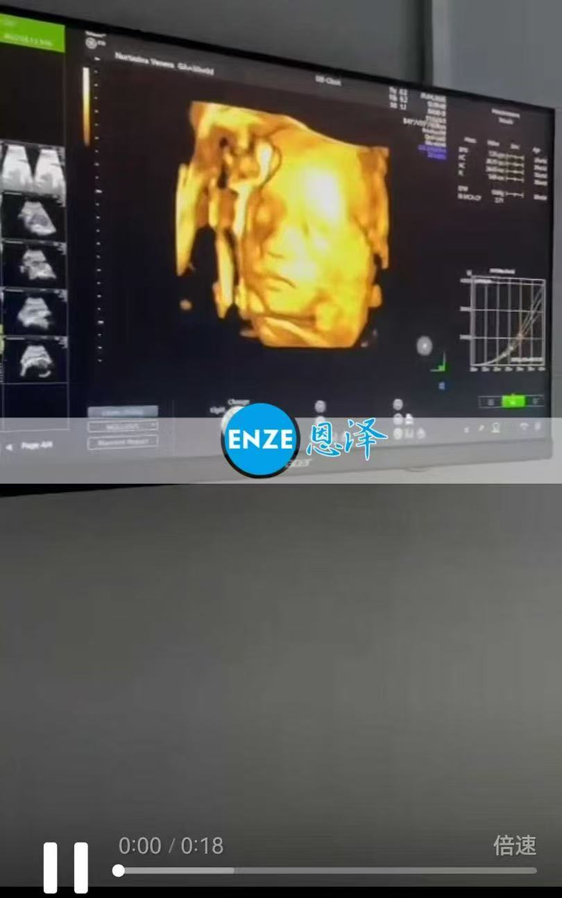 格鲁吉亚代孕代孕代母30周产检进展顺利
