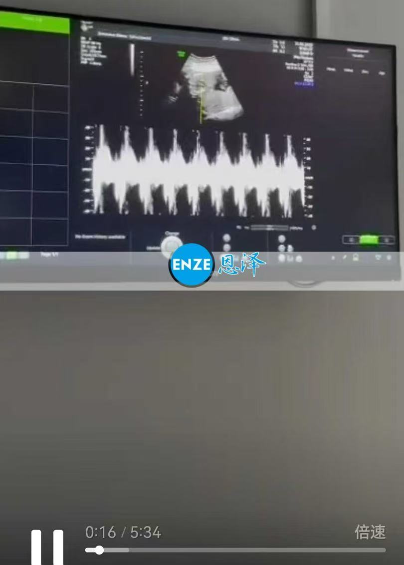 格鲁吉亚代孕代孕代母22周产检顺利通过