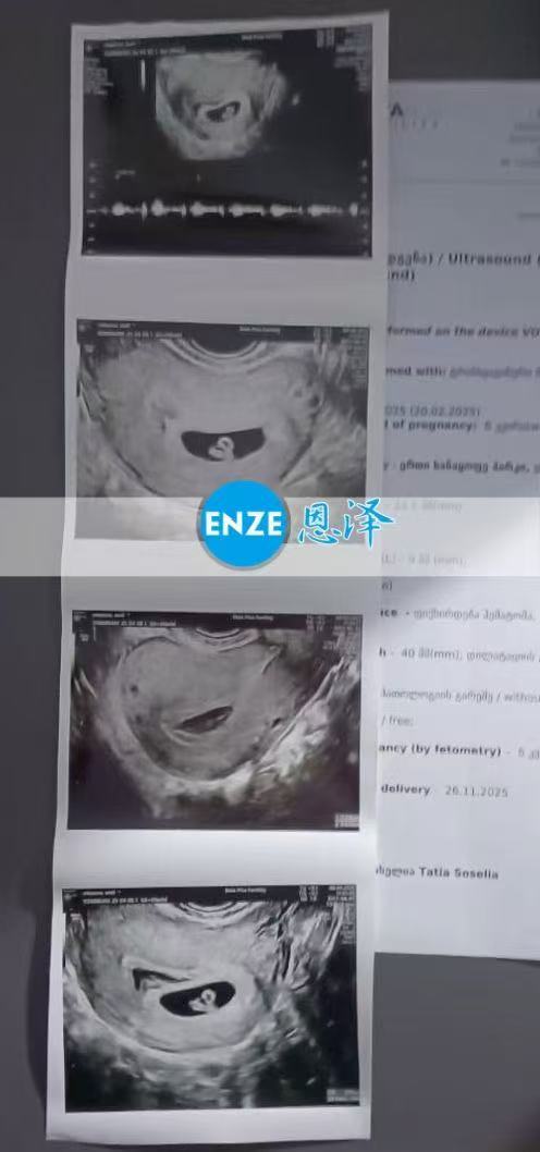 格鲁吉亚代孕代孕代母首次产检顺利过关