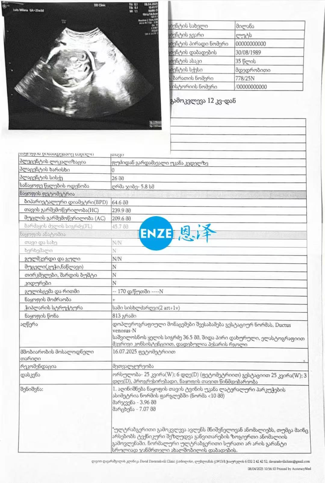 格鲁吉亚代孕代孕代母顺利通过25周产检
