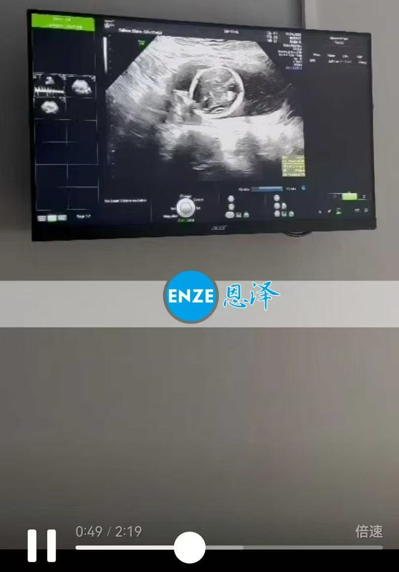 格鲁吉亚代孕代孕代母17周产检顺利完成