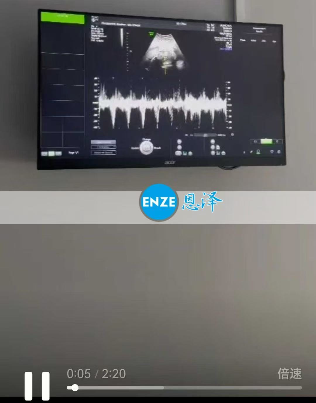 格鲁吉亚代孕代孕代母23周产检完美通过