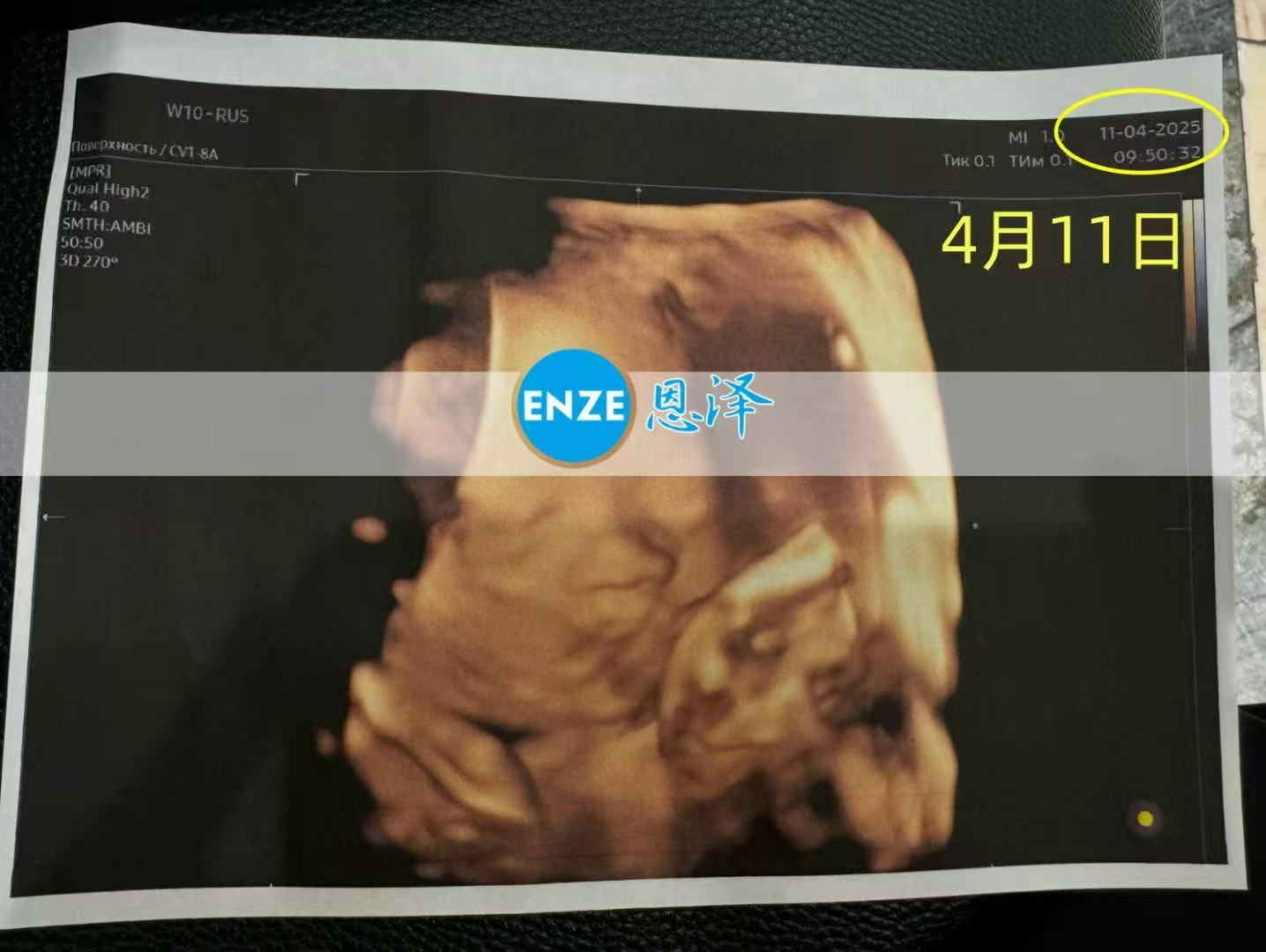 格鲁吉亚代孕代孕代母28周产检顺利通过