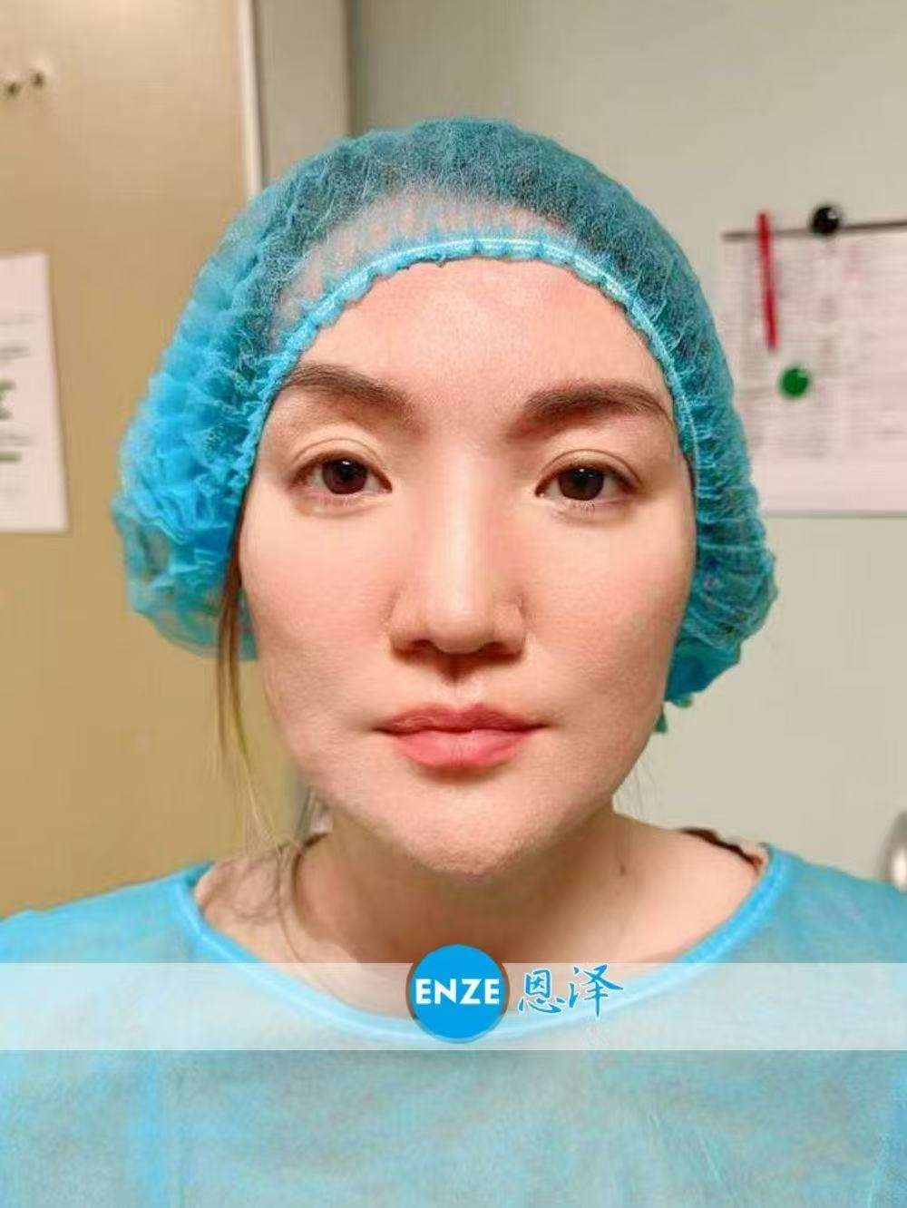 格鲁吉亚代孕代母着床成功