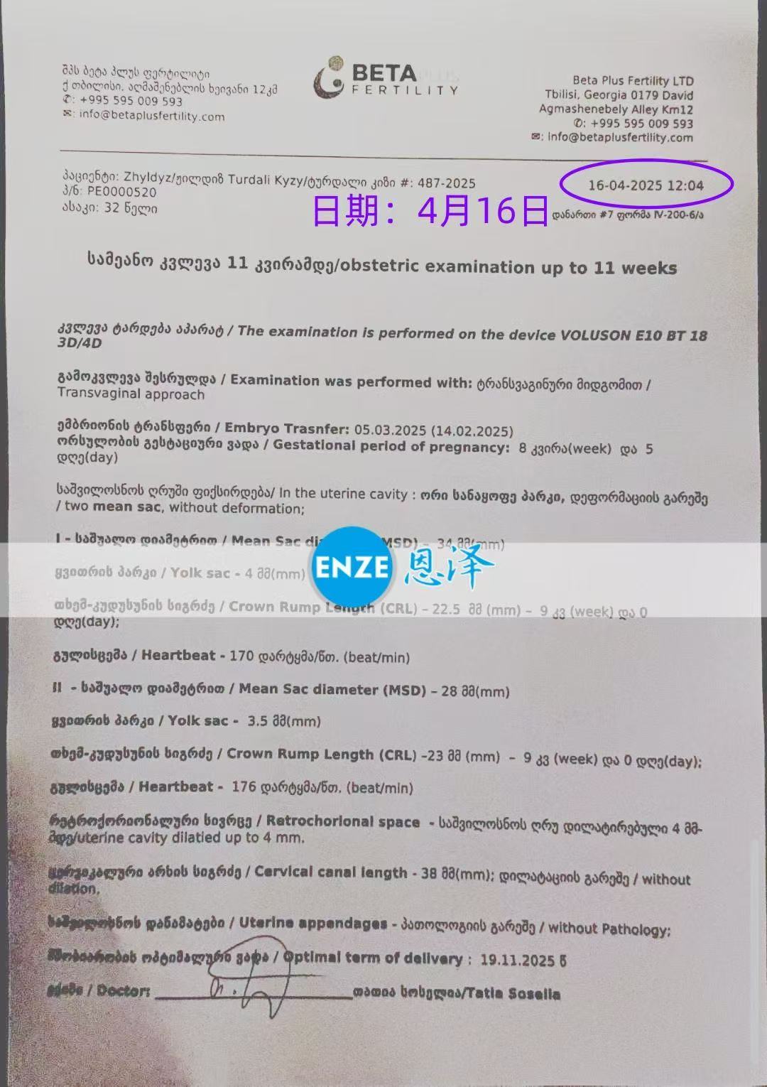 格鲁吉亚代孕代孕代母8周产检顺利通过