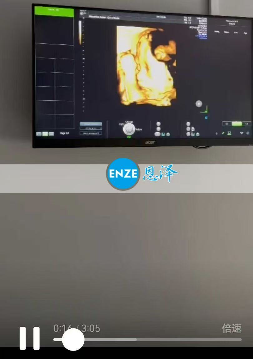 格鲁吉亚代孕代孕代母28周产检顺利通过