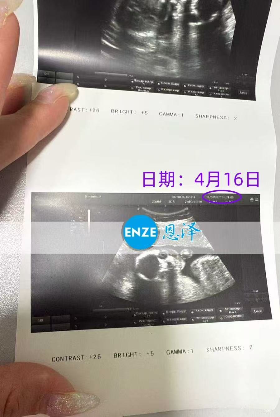 格鲁吉亚代孕代孕代母20周产检完美过关