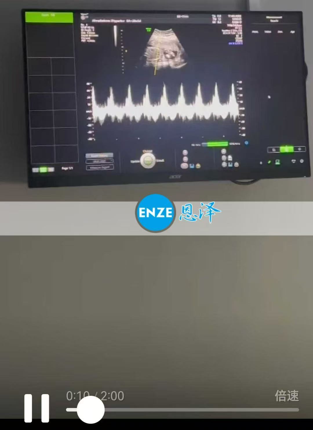 格鲁吉亚代孕代孕代母20周产检顺利通过