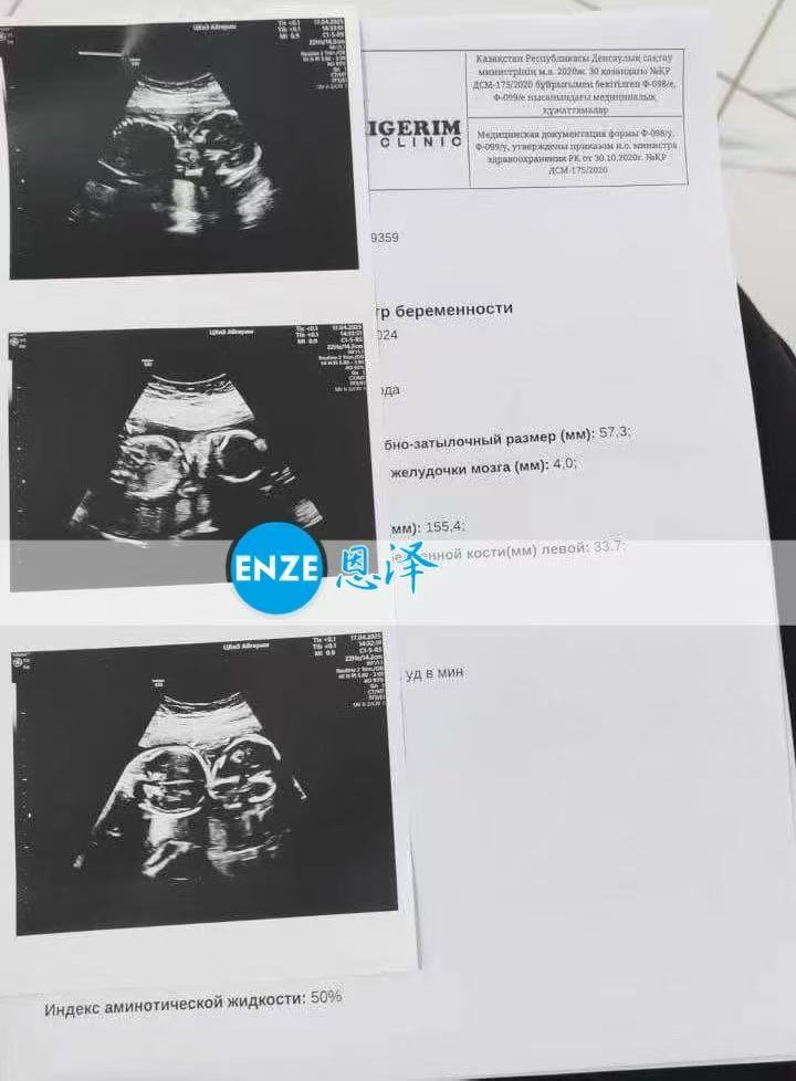 格鲁吉亚代孕代孕代母20周产检顺利通过