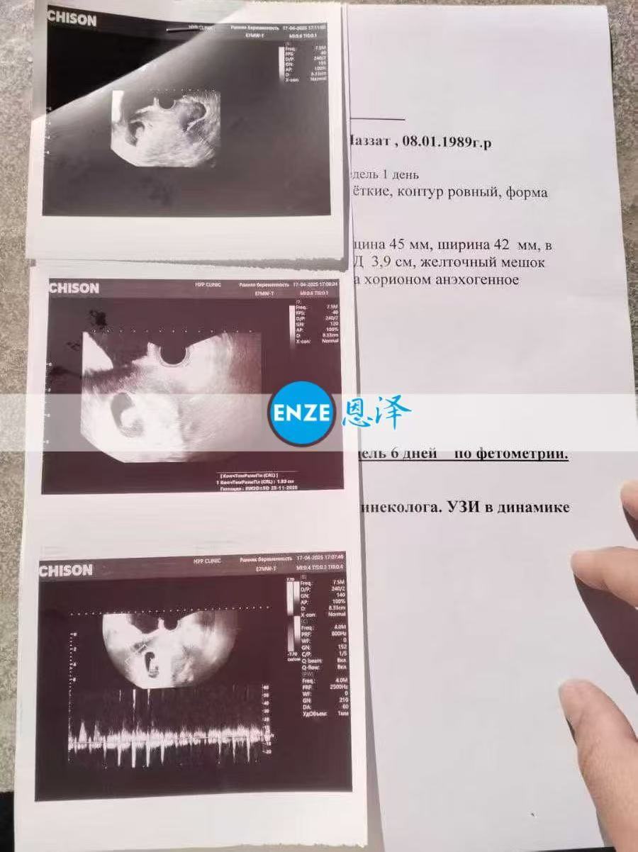 格鲁吉亚代孕代孕代母8周产检顺利过关