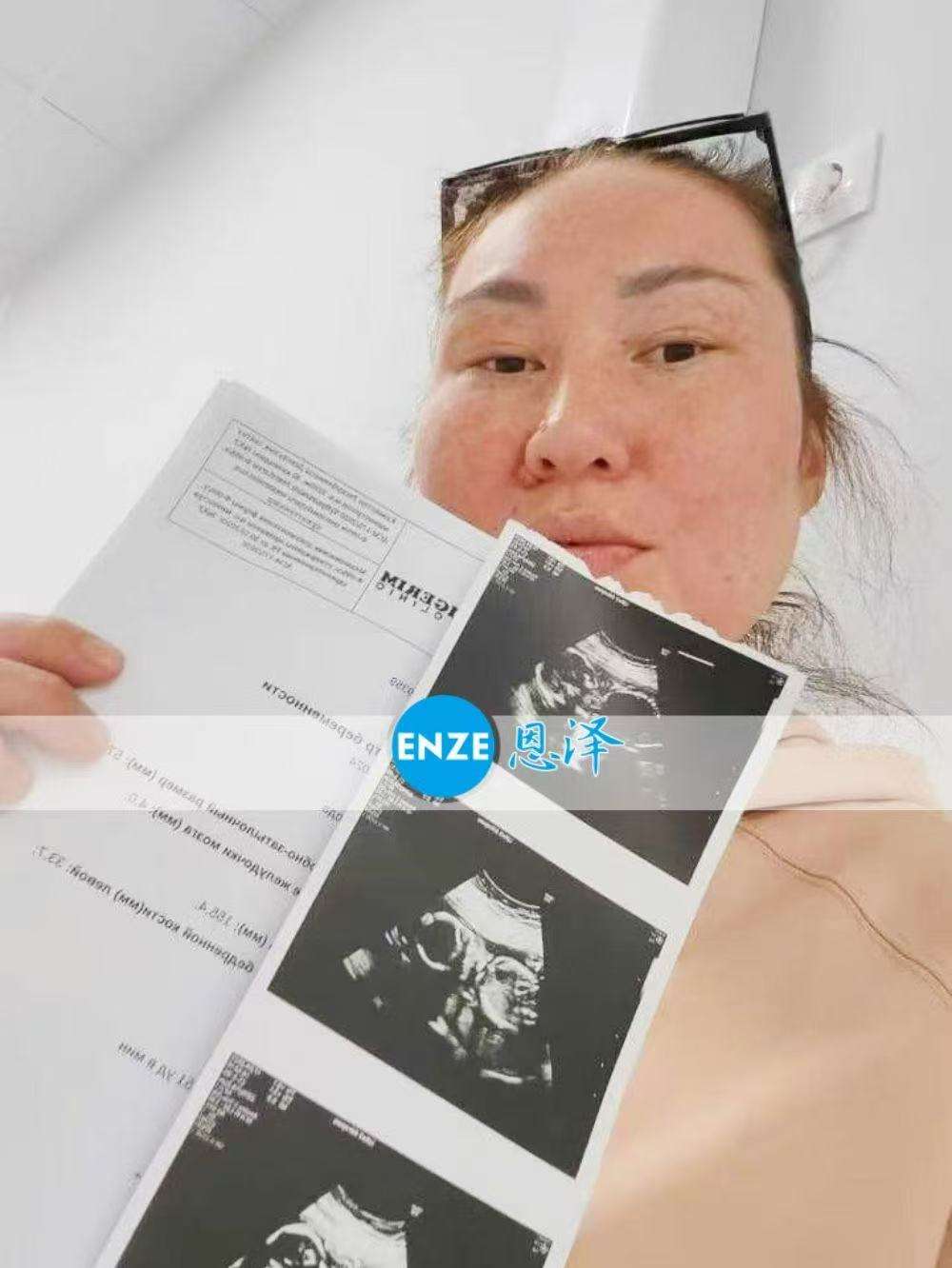 格鲁吉亚代孕代母20周产检顺利通过