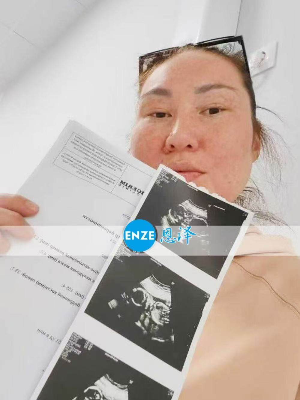 格鲁吉亚代孕代孕代母20周产检顺利通过
