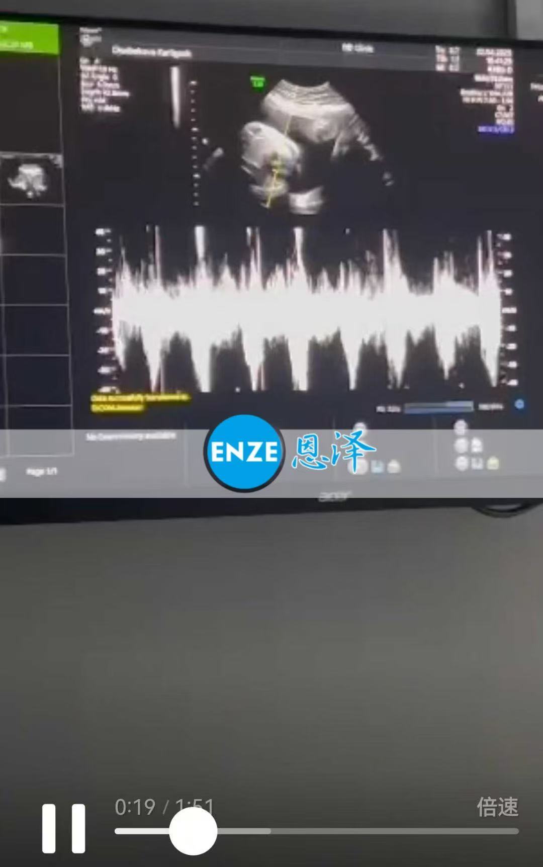 格鲁吉亚代孕代孕代母28周产检顺利通过