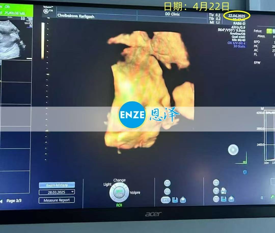 格鲁吉亚代孕代孕代母28周产检顺利通过