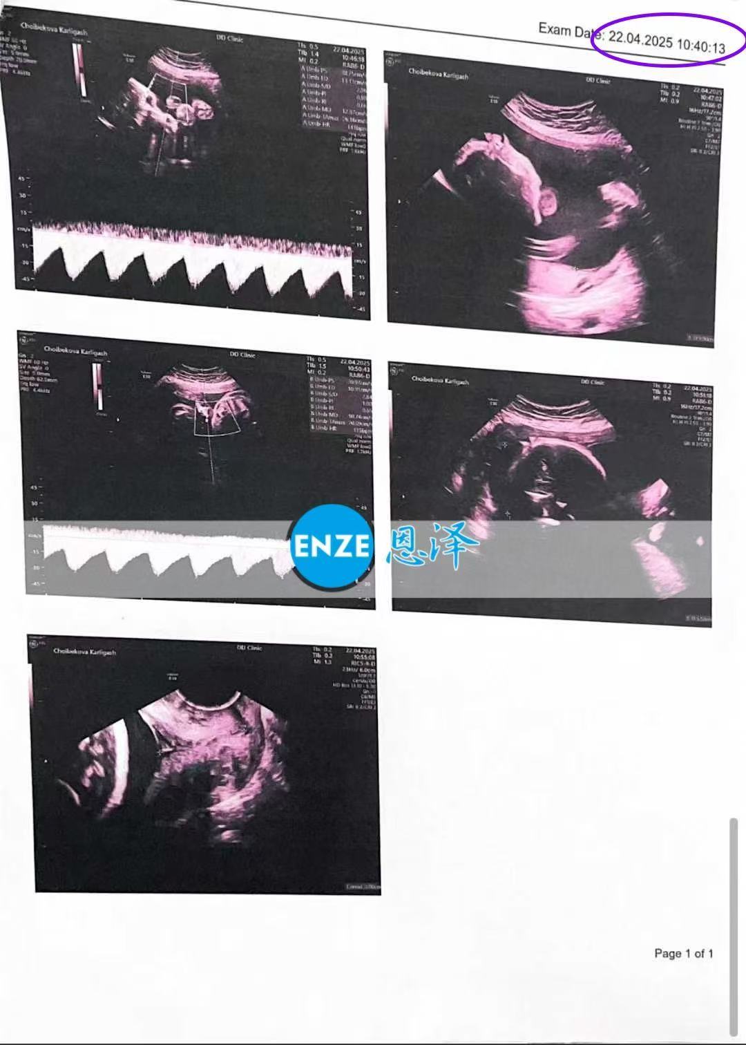 格鲁吉亚代孕代孕代母28周产检顺利通过