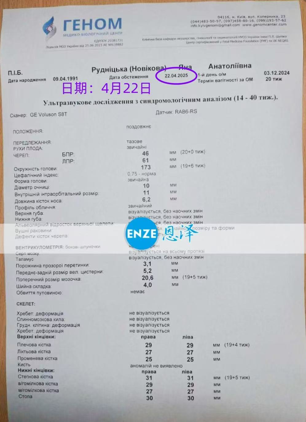 乌克兰代孕代孕代母19周产检顺利通过