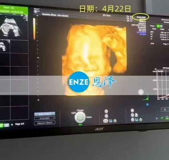 格鲁吉亚代孕代孕代母成功通过22周产检