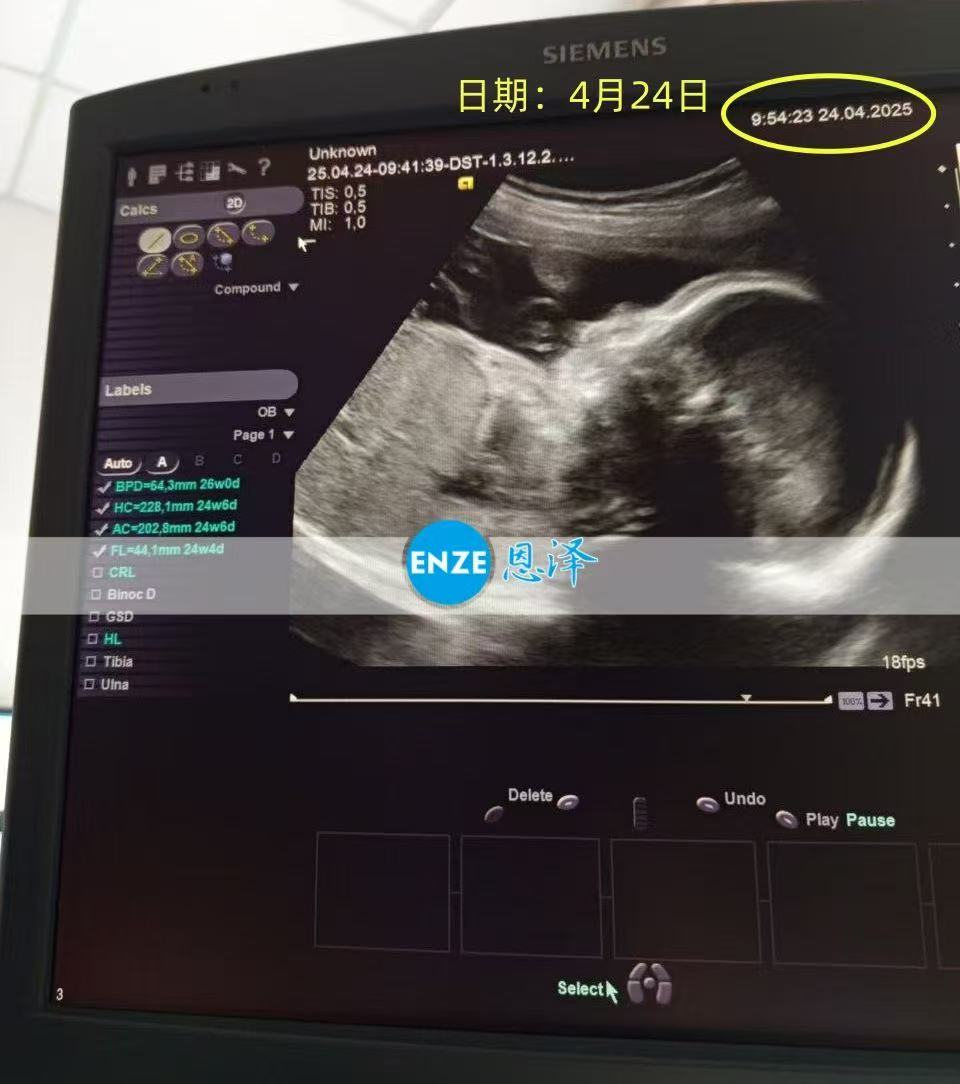 乌克兰代孕代孕代母20周产检顺利通过