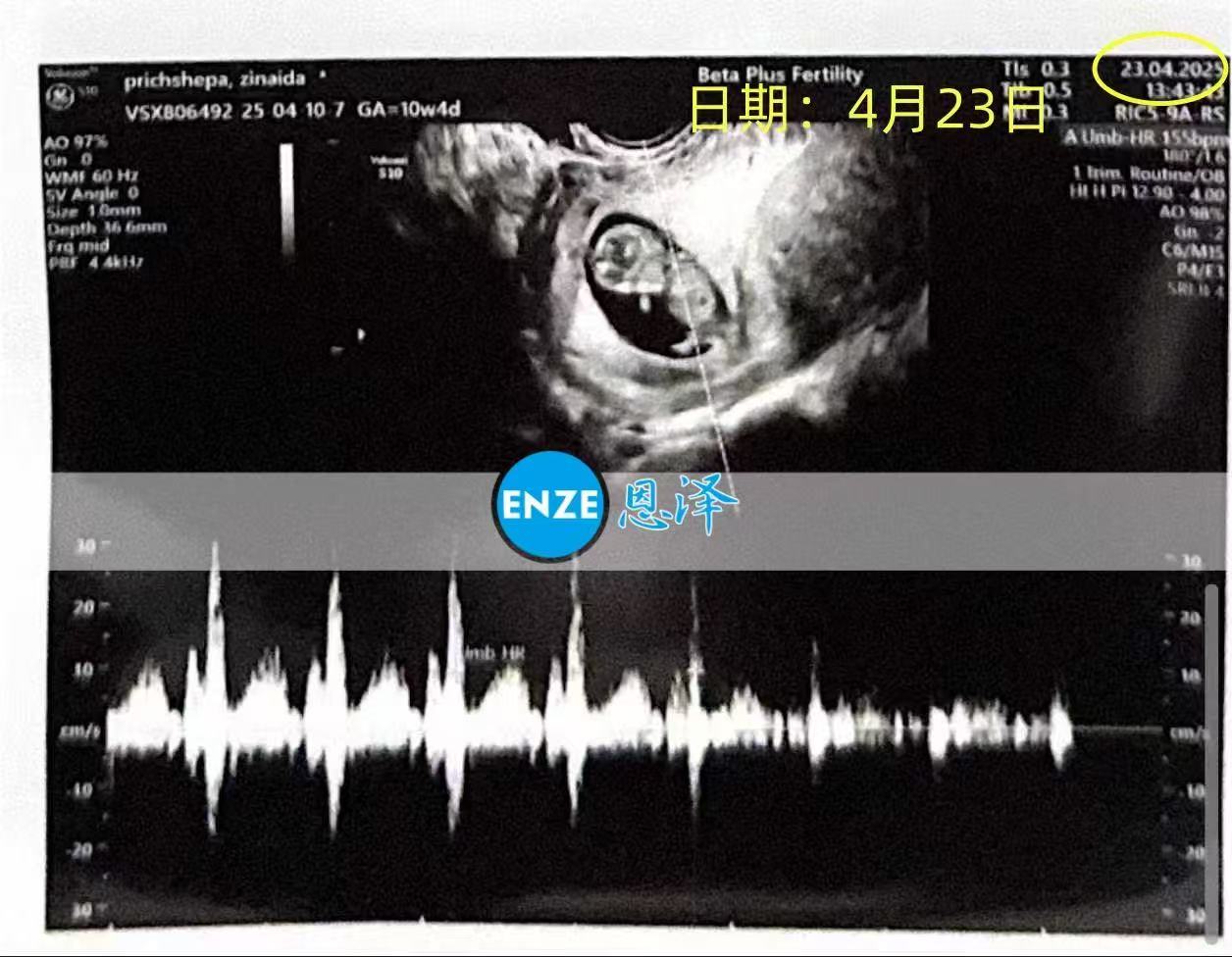 格鲁吉亚代孕双胎代孕代母通过10周产检