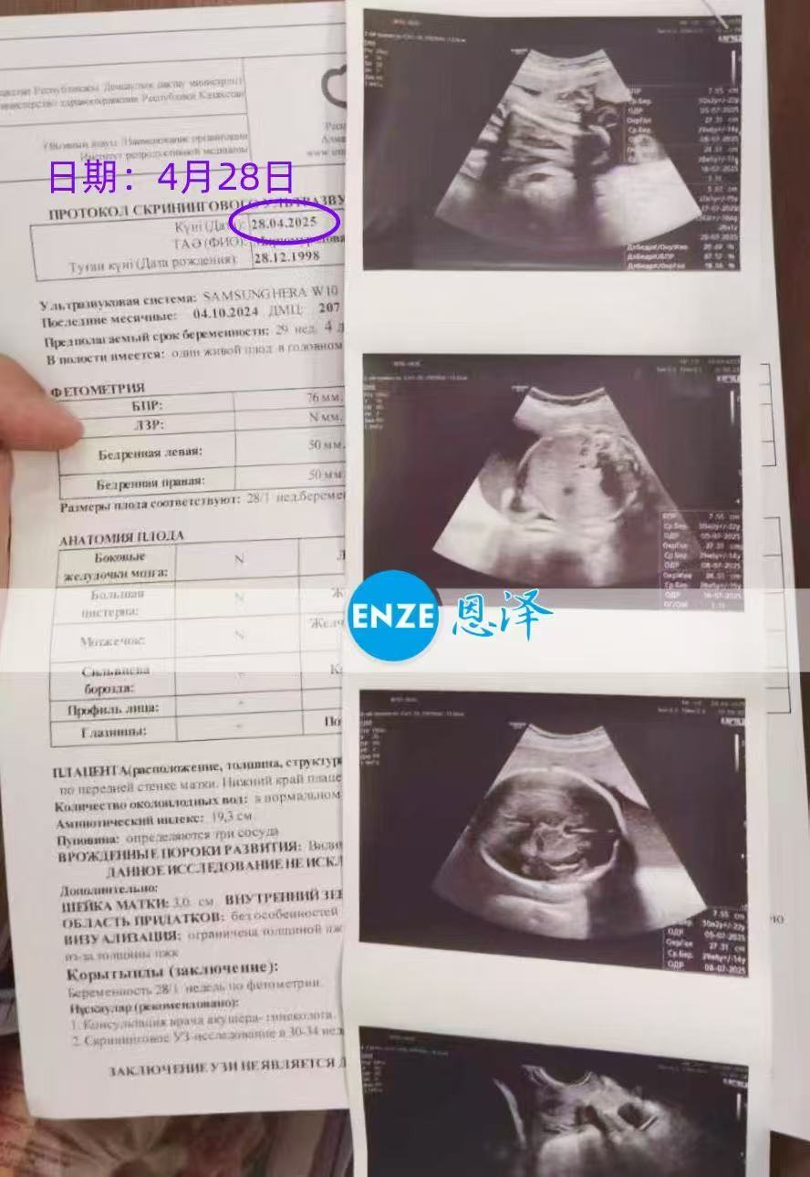 哈萨克斯坦代孕代孕代母成功通过29周产检