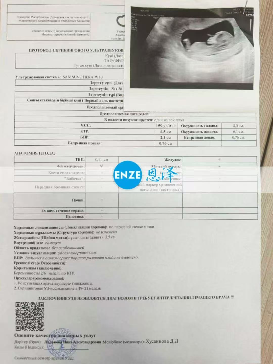 哈萨克斯坦代孕代孕代母12周产检顺利过关
