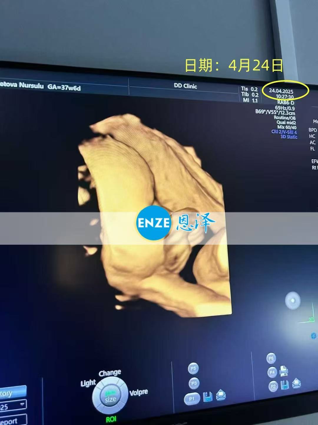 格鲁吉亚代孕代孕代母准备迎接宝贝诞生
