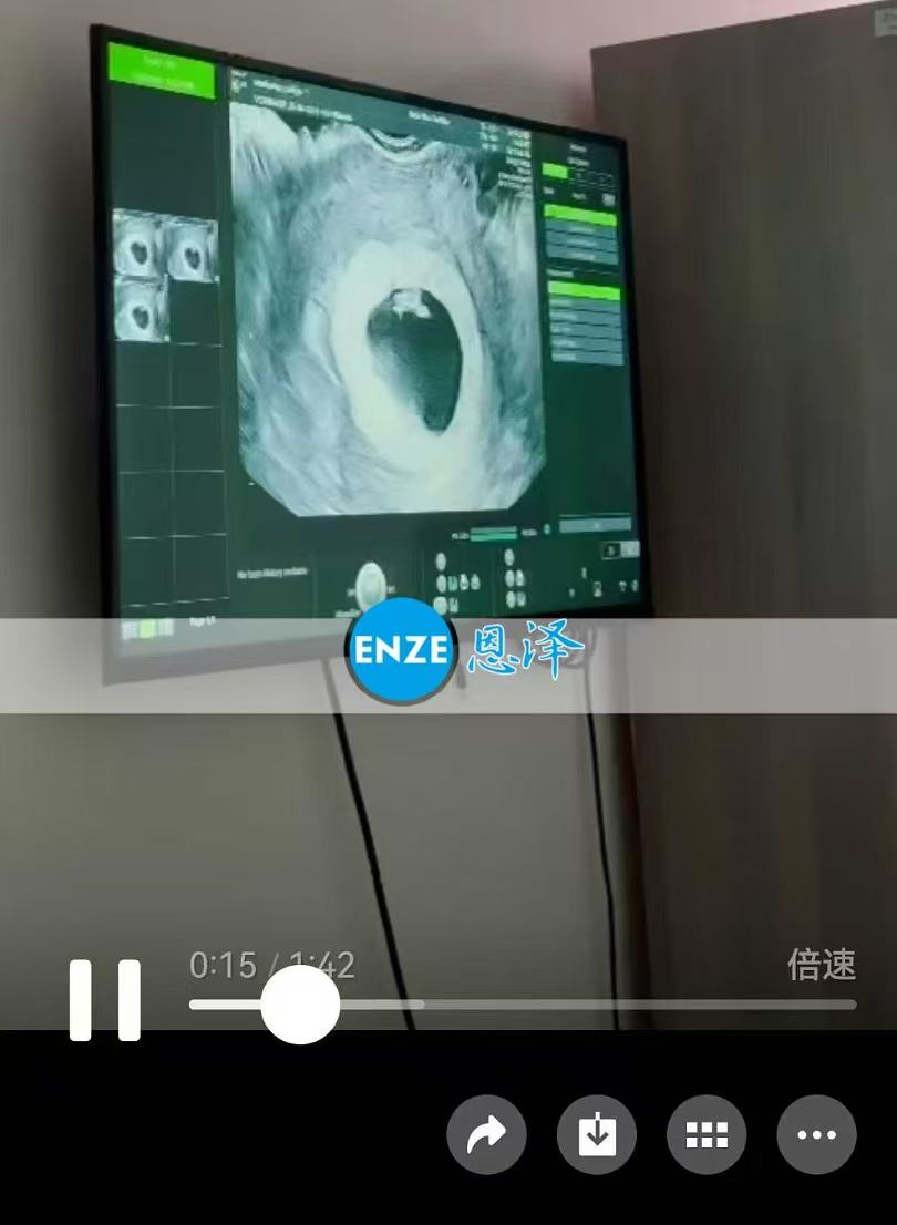 格鲁吉亚代孕代孕代母6周首检顺利通过