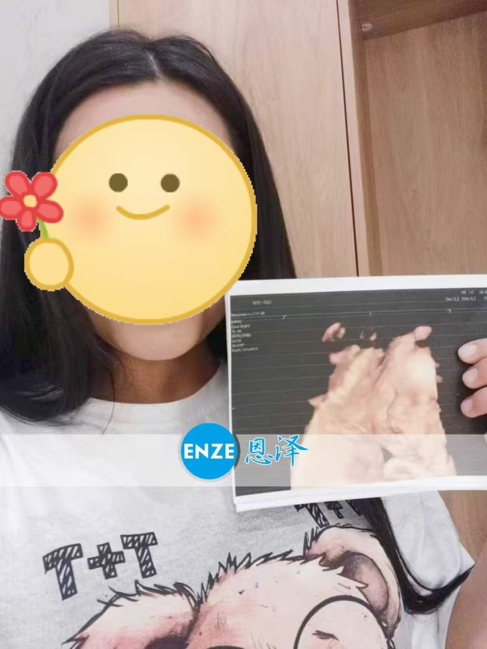 哈萨克斯坦代孕代孕代母成功通过29周产检