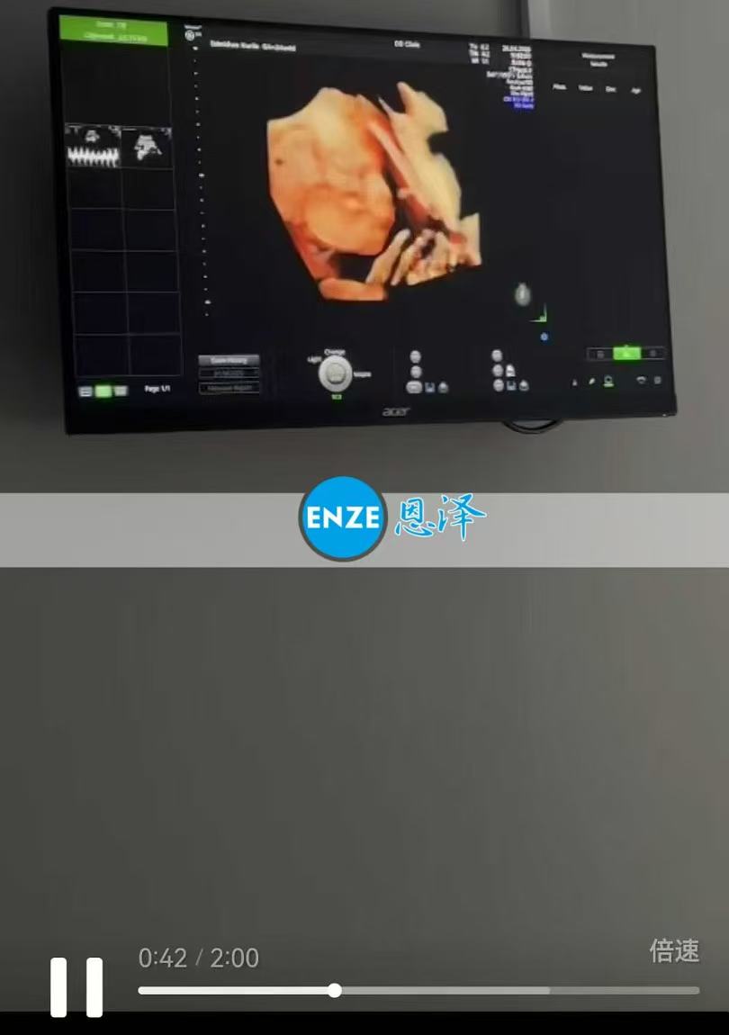 格鲁吉亚代孕代孕代母24周产检顺利通过