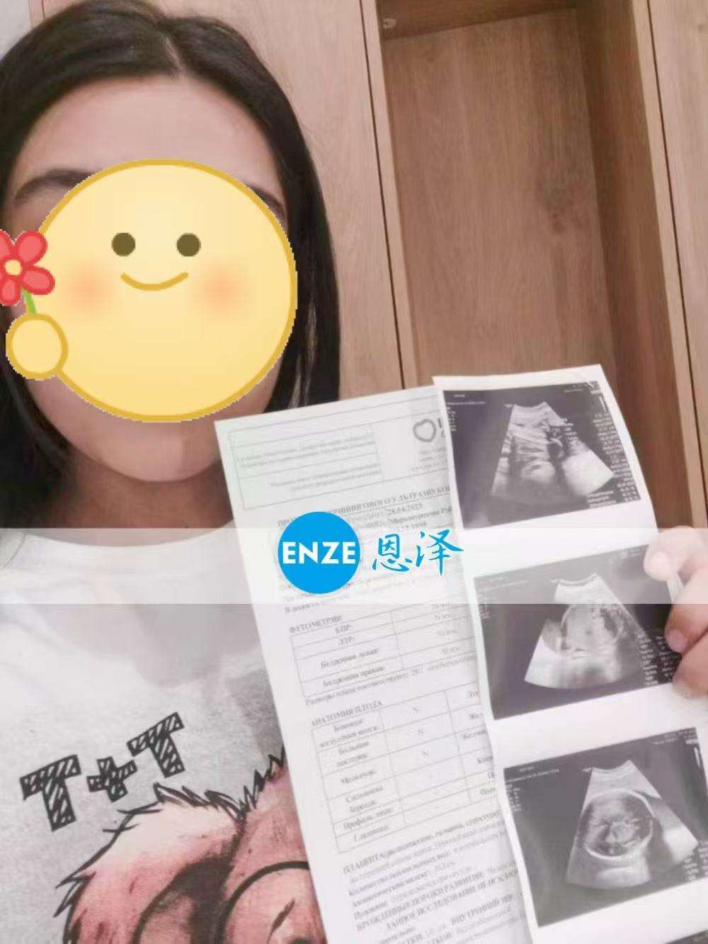 哈萨克斯坦代孕代母成功通过29周产检