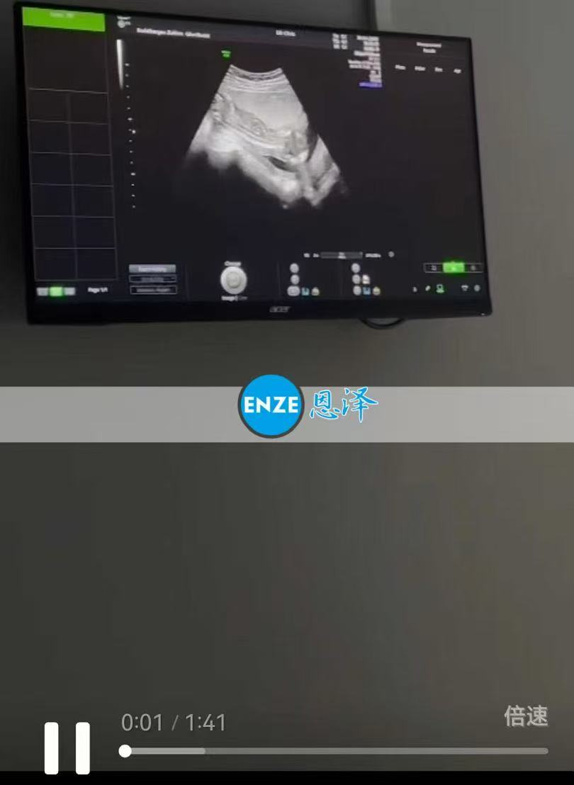 格鲁吉亚代孕代孕代母16周产检顺利过关
